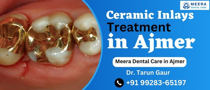 Ceramic Inlays Treatment Ajmer