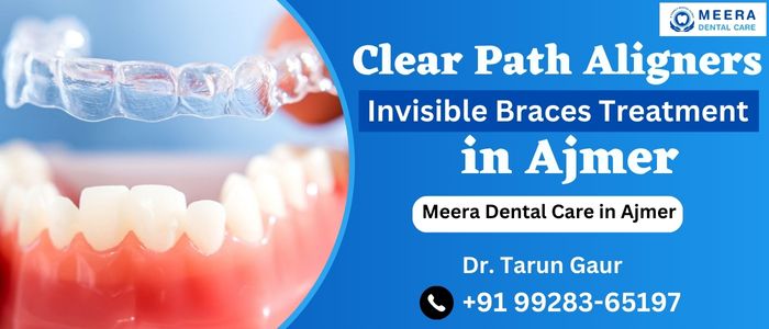 Clear Path Aligners Invisible Braces Treatment Ajmer