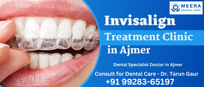 Invisalign Treatment Ajmer