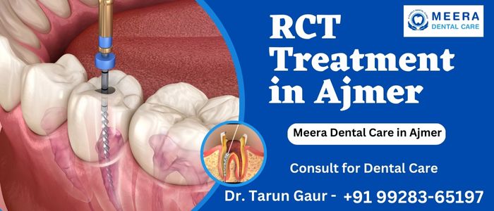 RCT Treatment in Ajmer
